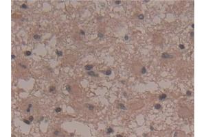 Immunohistochemistry (IHC) image for anti-Anoctamin 6 (ANO6) (AA 744-824) antibody (ABIN7436141)