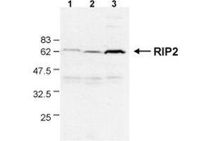 Detection of endogenous human RIP2 in different human cell lines by the MAb to RIP2 (Nick-1) . (RIP2 antibody  (AA 1-322))