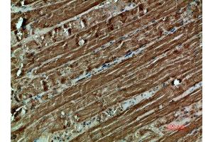 Immunohistochemical analysis of paraffin-embedded human-muscle, antibody was diluted at 1:200 (Cytochrome C antibody  (AA 1268-1341))