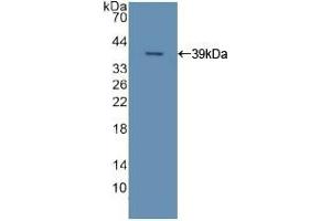 Detection of Recombinant APOC2, Human using Polyclonal Antibody to Apolipoprotein C2 (APOC2) (Apolipoprotein C-II antibody  (AA 13-97))