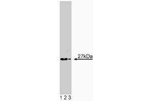 Western blot analysis of Syntaxin 8 on human cell endothelial lysate.