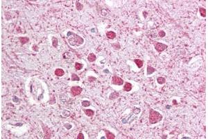 Anti-CEBPG / CEBP Gamma antibody IHC staining of human brain, cortex. (CEBPG antibody  (AA 139-150))
