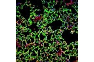 Bleomycin-induced lung injury in WT mice: Confocal images of untreated and bleomycin-treated WT lung stained with antibodies against PDGFRβ and RAGE to illustrate fibrotic foci at sites of epithelial damage. (RAGE antibody  (Extracellular Domain))