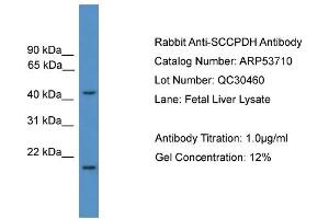 WB Suggested Anti-SCCPDH  Antibody Titration: 0. (SCCPDH antibody  (Middle Region))