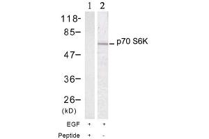 Image no. 2 for anti-Ribosomal Protein S6 Kinase, 70kDa, Polypeptide 1 (RPS6KB1) (Thr389) antibody (ABIN197396) (RPS6KB1 antibody  (Thr389))
