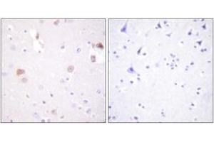 Immunohistochemistry analysis of paraffin-embedded human brain tissue, using PLD1 (Ab-561) Antibody. (PLD1 antibody  (AA 527-576))