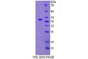SDS-PAGE (SDS) image for ADP-Ribosyltransferase 4 (Dombrock Blood Group) (ART4) (AA 51-275) protein (His tag) (ABIN4988505)
