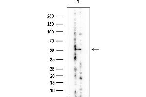 anti-Solute Carrier Family 46, Member 3 (SLC46A3) antibody