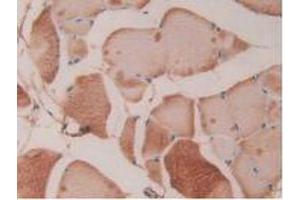 IHC-P analysis of Rat Skeletal Muscle Tissue, with DAB staining.