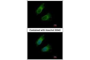 ICC/IF Image Immunofluorescence analysis of methanol-fixed HeLa, using GOT2, antibody at 1:500 dilution. (GOT2 antibody  (Center))