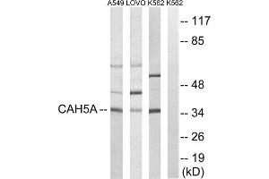 Western Blotting (WB) image for anti-Carbonic Anhydrase VA (CA5A) (Internal Region) antibody (ABIN1851008) (CA5A antibody  (Internal Region))