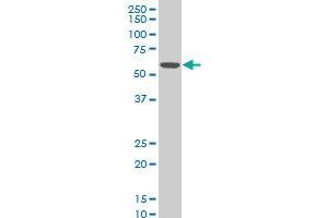 PDLIM5 polyclonal antibody (A02), Lot # NNR0051021QC01 Western Blot analysis of PDLIM5 expression in Hela S3 NE . (PDLIM5 antibody  (AA 1-596))