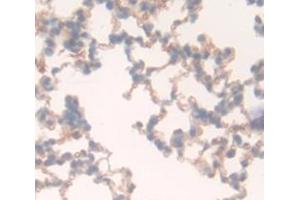 Used in DAB staining on fromalin fixed paraffin- embedded Kidney tissue (FLT1 antibody  (AA 18-308))