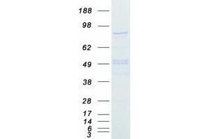 Validation with Western Blot (SUZ12 Protein (Myc-DYKDDDDK Tag))