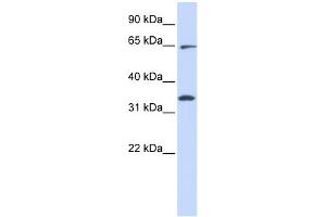 WB Suggested Anti-RHOT1 Antibody Titration:  0. (RHOT1 antibody  (Middle Region))