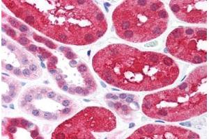 Human Kidney (formalin-fixed, paraffin-embedded) stained with XIAP antibody ABIN214586 at 2 ug/ml followed by biotinylated goat anti-rabbit IgG secondary antibody ABIN481713, alkaline phosphatase-streptavidin and chromogen. (XIAP antibody  (C-Term))