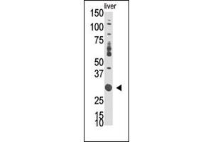 Western Blotting (WB) image for anti-Docking Protein 5 (DOK5) (N-Term) antibody (ABIN359962) (DOK5 antibody  (N-Term))