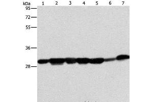 Western Blot analysis of Human placenta tissue and A549 cell, Mouse brain tissue and hepG2 cell, Raji cell and Human fetal liver tissue, hela cell using AK2 Polyclonal Antibody at dilution of 1:300 (Adenylate Kinase 2 antibody)