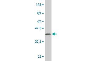Western Blot detection against Immunogen (36. (KAT2A antibody  (AA 738-837))
