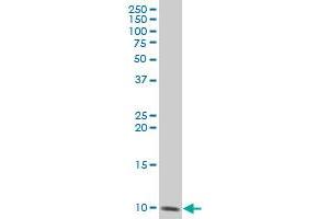 DBI polyclonal antibody (A01), Lot # 060613JCS1 Western Blot analysis of DBI expression in SJCRH30 . (Diazepam Binding Inhibitor antibody  (AA 1-104))