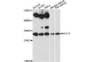 Western blot analysis of extracts of various cell lines, using KLK13 antibody (ABIN6293043) at 1:3000 dilution.