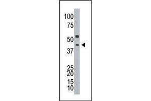 Image no. 1 for anti-Ataxin 3 (ATXN3) (N-Term) antibody (ABIN357621) (Ataxin 3 antibody  (N-Term))