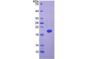 SDS-PAGE (SDS) image for Matrix Metallopeptidase 9 (Gelatinase B, 92kDa Gelatinase, 92kDa Type IV Collagenase) (MMP9) ELISA Kit (ABIN6574164)