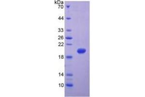SDS-PAGE of Protein Standard from the Kit (Highly purified E. (MMP 9 ELISA Kit)