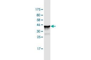 Western Blot detection against Immunogen (36. (CANT1 antibody  (AA 302-401))