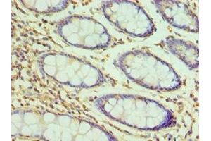 Immunohistochemistry of paraffin-embedded human colon tissue using ABIN7155385 at dilution of 1:100 (H2AFZ antibody  (AA 1-128))