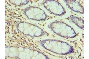 Immunohistochemistry of paraffin-embedded human colon tissue using ABIN7155385 at dilution of 1:100