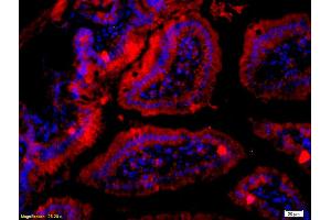 Formalin-fixed and paraffin embedded mouse intestine labeled with Anti- RET Polyclonal Antibody, Unconjugated (ABIN680788) at 1:200 followed by conjugation to the secondary antibody Goat Anti-Rabbit IgG, Cy3 conjugated used at 1:200 dilution for 40 minutes at 37°C and DAPI staining (Ret Proto-Oncogene antibody  (AA 1001-1114))