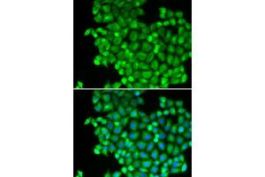 Immunofluorescence analysis of A549 cell using LDHA antibody. (Lactate Dehydrogenase A antibody  (AA 1-332))