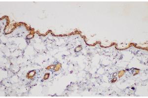 Immunohistochemistry (Paraffin-embedded Sections) (IHC (p)) image for anti-Plasminogen Activator Inhibitor 2 (SERPINB2) antibody (ABIN7234543)