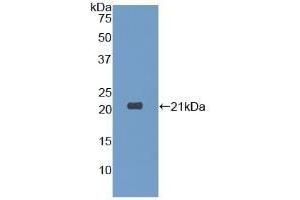 Detection of Recombinant DPT, Human using Polyclonal Antibody to Dermatopontin (DPT) (Dermatopontin antibody  (AA 26-197))