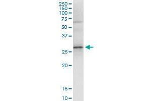 Immunoprecipitation of GCLM transfected lysate using anti-GCLM MaxPab rabbit polyclonal antibody and Protein A Magnetic Bead , and immunoblotted with GCLM purified MaxPab mouse polyclonal antibody (B01P) . (GCLM antibody  (AA 1-274))