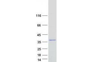 Validation with Western Blot (Nebulette Protein (NEBL) (Transcript Variant 2) (Myc-DYKDDDDK Tag))