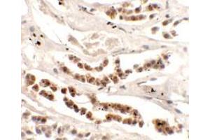 Immunohistochemistry of DISP1 in human kidney tissue with DISP1 Antibody (N-term) at 2. (DISP1 antibody  (N-Term))