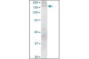 Western Blotting (WB) image for anti-Collagen, Type I (COL1) antibody (ABIN782308) (Collagen Type I antibody)