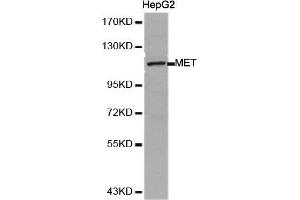 Western Blotting (WB) image for anti-Met Proto-Oncogene (MET) (AA 25-325) antibody (ABIN6213594) (c-MET antibody  (AA 25-325))
