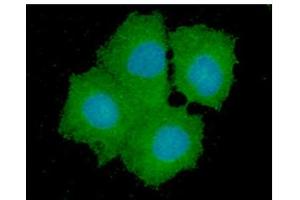 ICC/IF analysis of GPD1L in Hep3B cells line, stained with DAPI (Blue) for nucleus staining and monoclonal anti-human GPD1L antibody (1:100) with goat anti-mouse IgG-Alexa fluor 488 conjugate (Green). (GPD1L antibody)