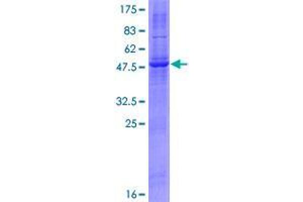 RNF182 Protein (AA 1-247) (GST tag)