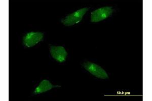 Immunofluorescence of purified MaxPab antibody to MGAT1 on HeLa cell. (MGAT1 antibody  (AA 1-445))