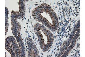 Image no. 3 for anti-Dihydrolipoamide Dehydrogenase (DLD) antibody (ABIN1497845) (DLD antibody)