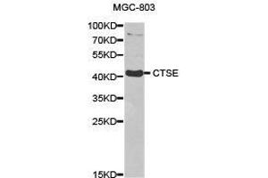 Western Blotting (WB) image for anti-Cathepsin E (CTSE) antibody (ABIN1872100)