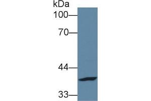 Western blot analysis of Human A431 cell lysate, using Mouse FPGT Antibody (1 µg/ml) and HRP-conjugated Goat Anti-Rabbit antibody ( (FPGT antibody  (AA 314-513))