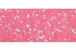 Detection of SYN1 in Human Cortex Tissue using Polyclonal Antibody to Synapsin I (SYN1) (SYN1 antibody  (AA 113-420))