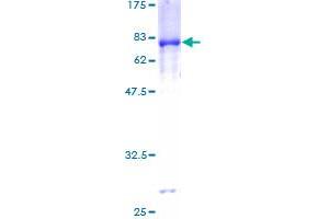 PDHA1 Protein (AA 1-390) (GST tag)