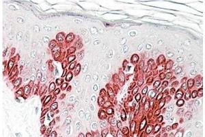 AP23761PU-N SIRT1 antibody staining of paraffin embedded Human Skin at 3. (SIRT1 antibody  (Internal Region))