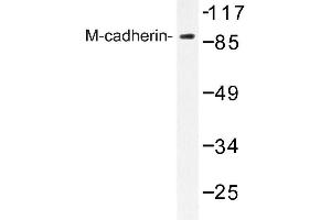 Image no. 1 for anti-M-Cadherin (CDH15) antibody (ABIN272294) (CDH15 antibody)